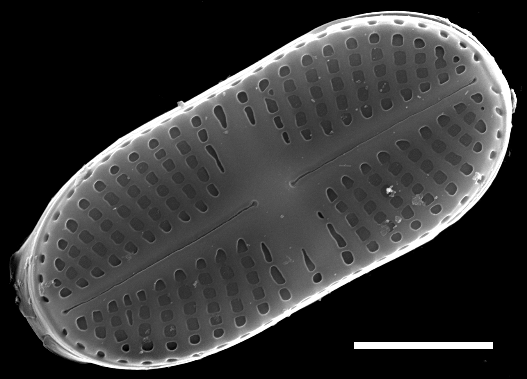 Psammothidium didymum SEM3