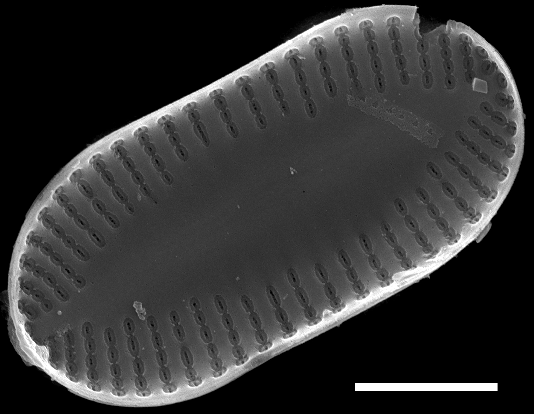 Psammothidium didymum SEM5