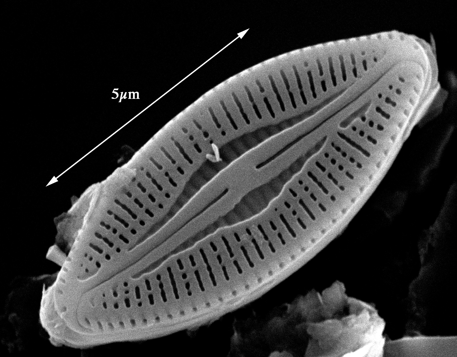 Microcostatus krasskei SEM1