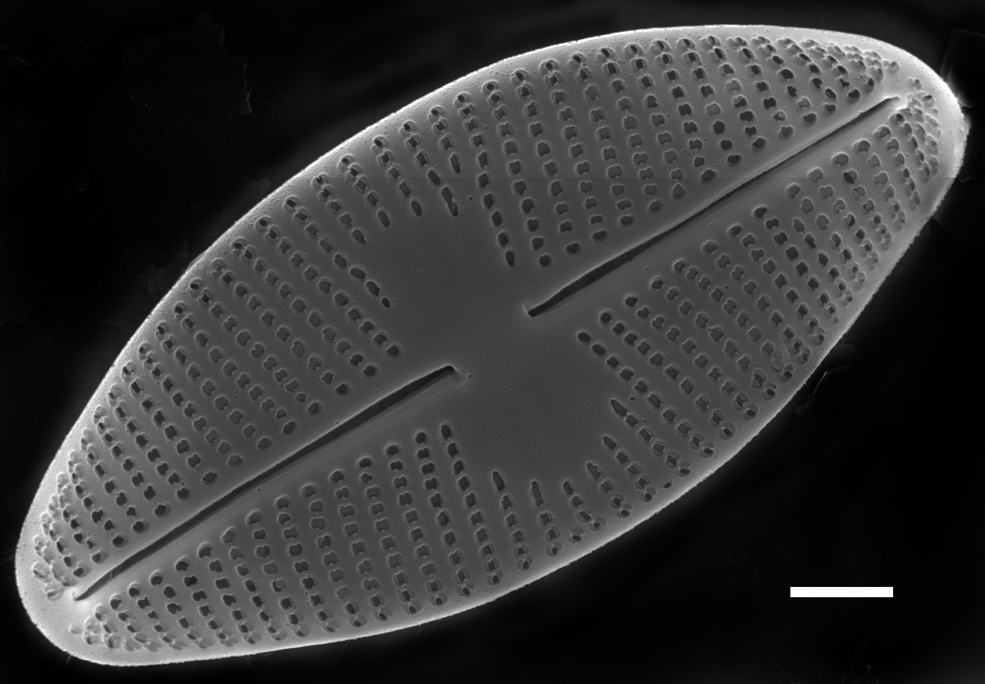 Psammothidium altaicum SEM1