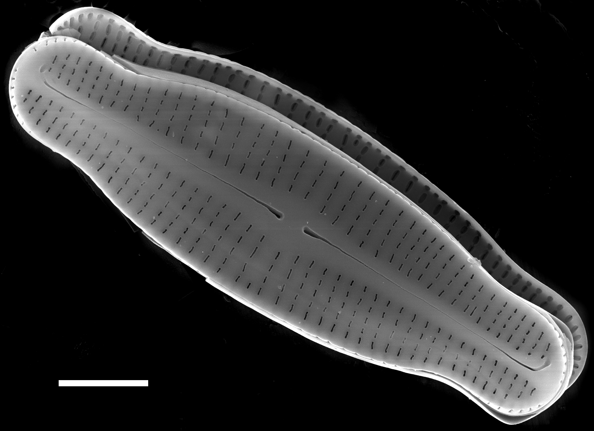 Achnanthidium latecephalum SEM3