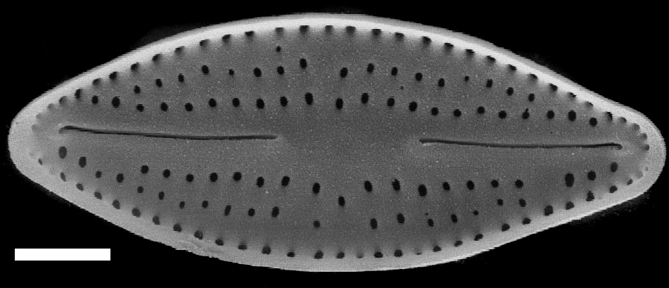 Nupela neglecta SEM1