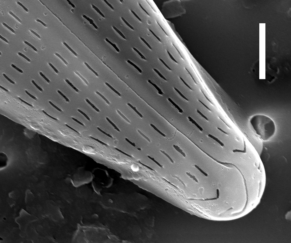Navicula aitchelbee SEM1
