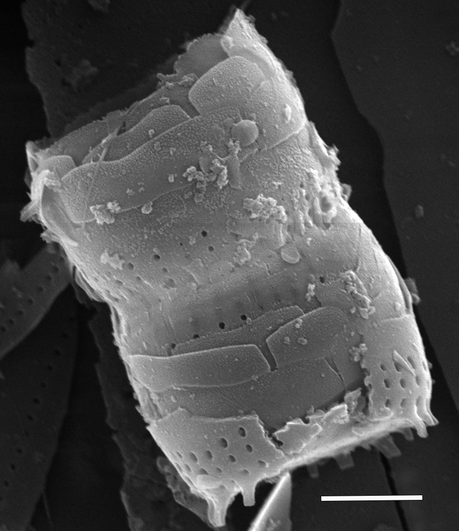 Nanofrustulum cataractum SEM1