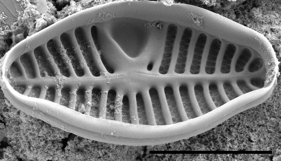 Planothidium californicum SEM1