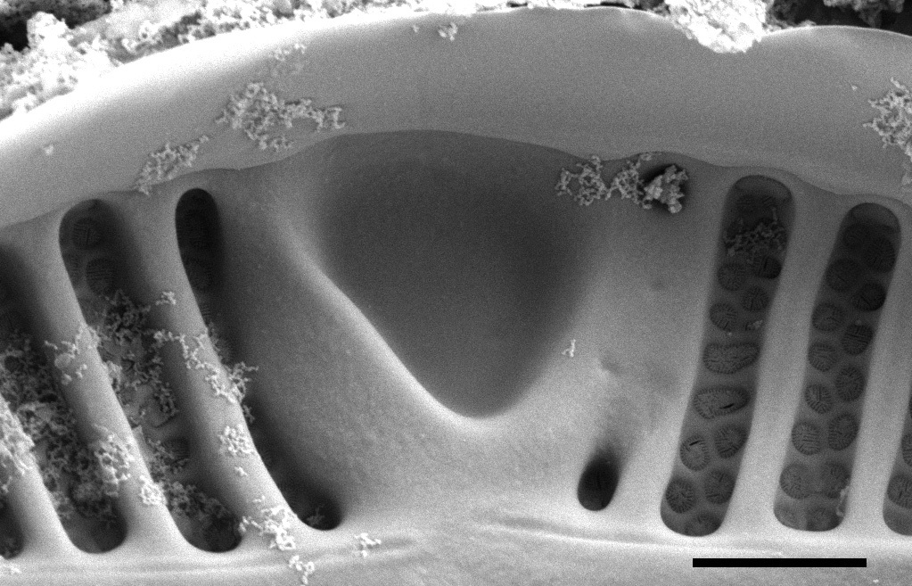 Planothidium californicum SEM2