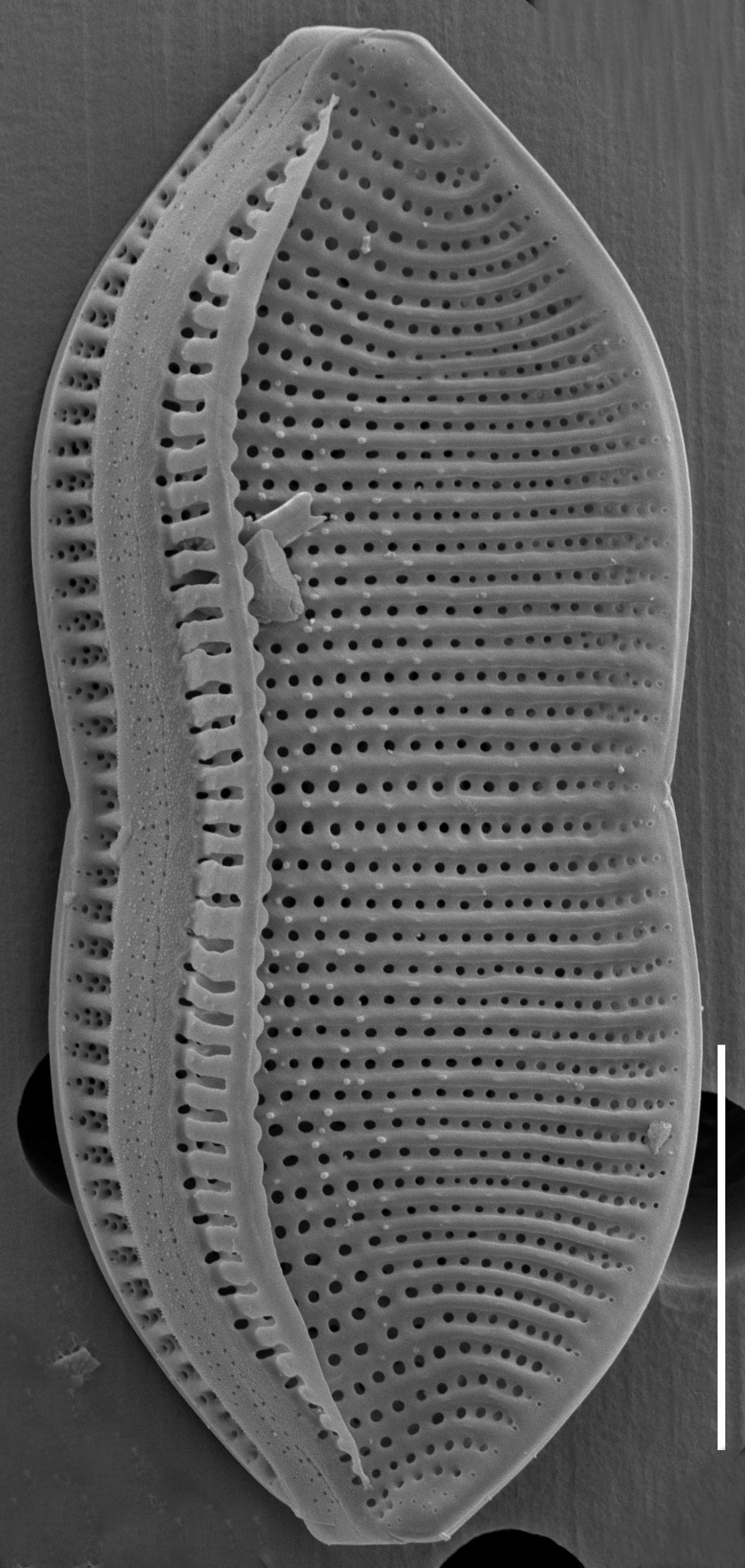 Psammodictyon constrictum SEM1