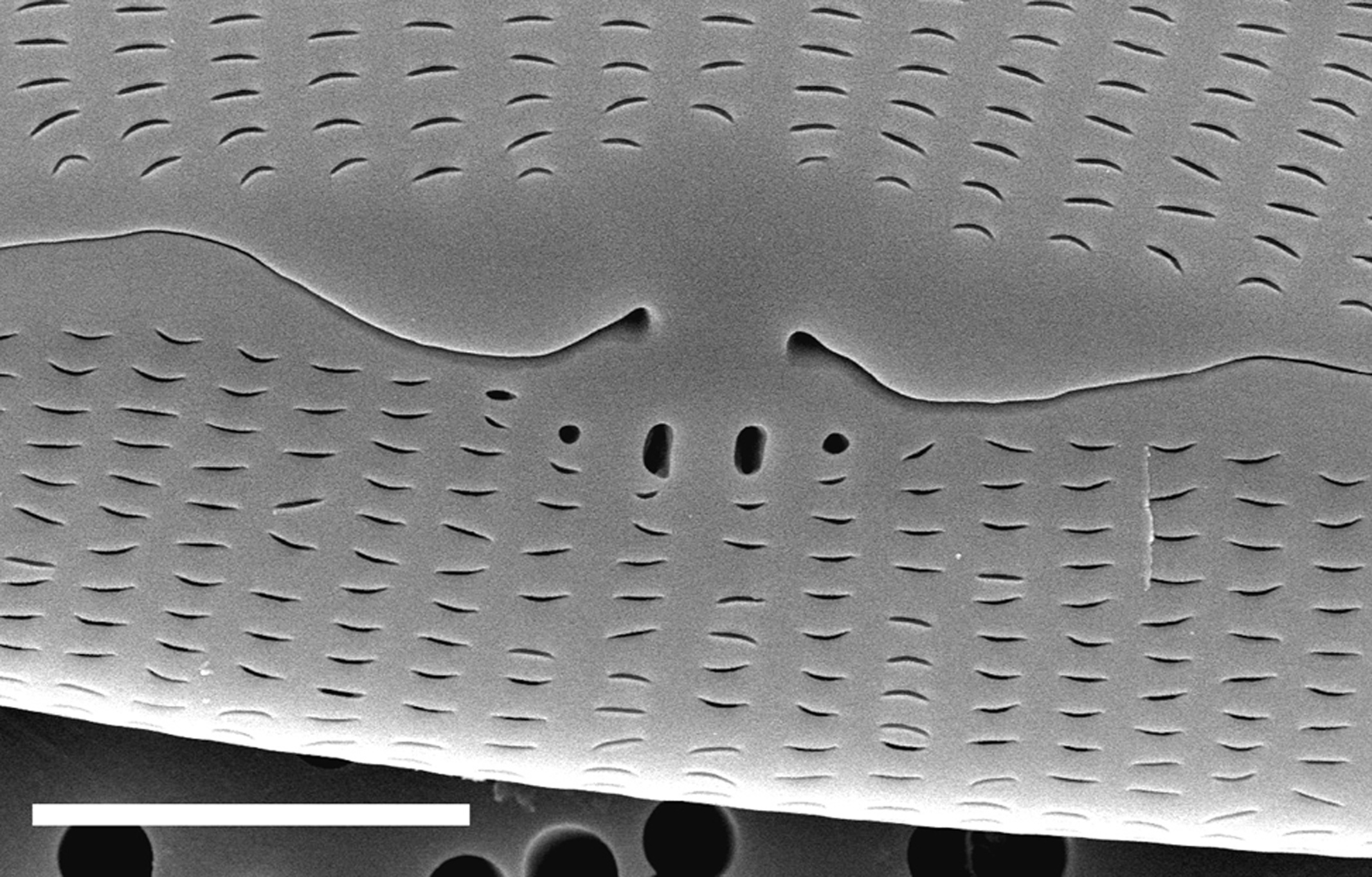 Sem External Middle5Microns