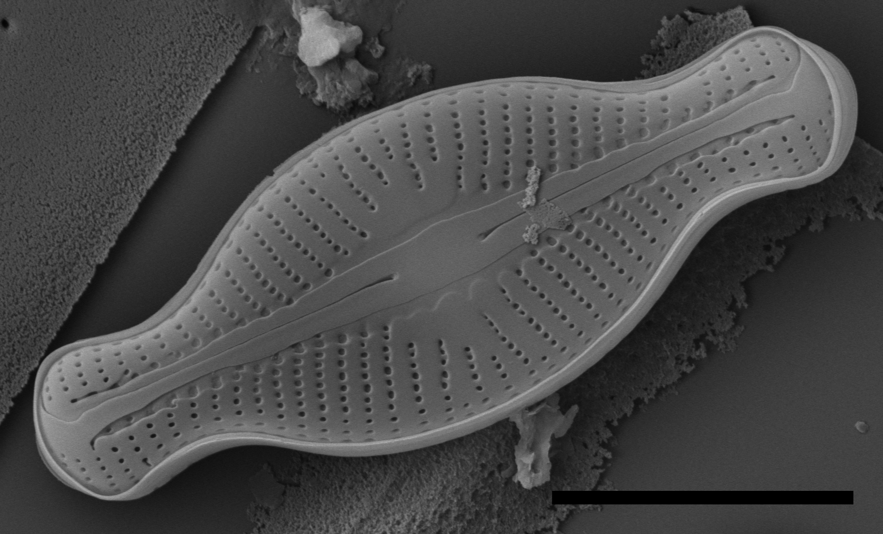 Sellaphora schadei SEM 1