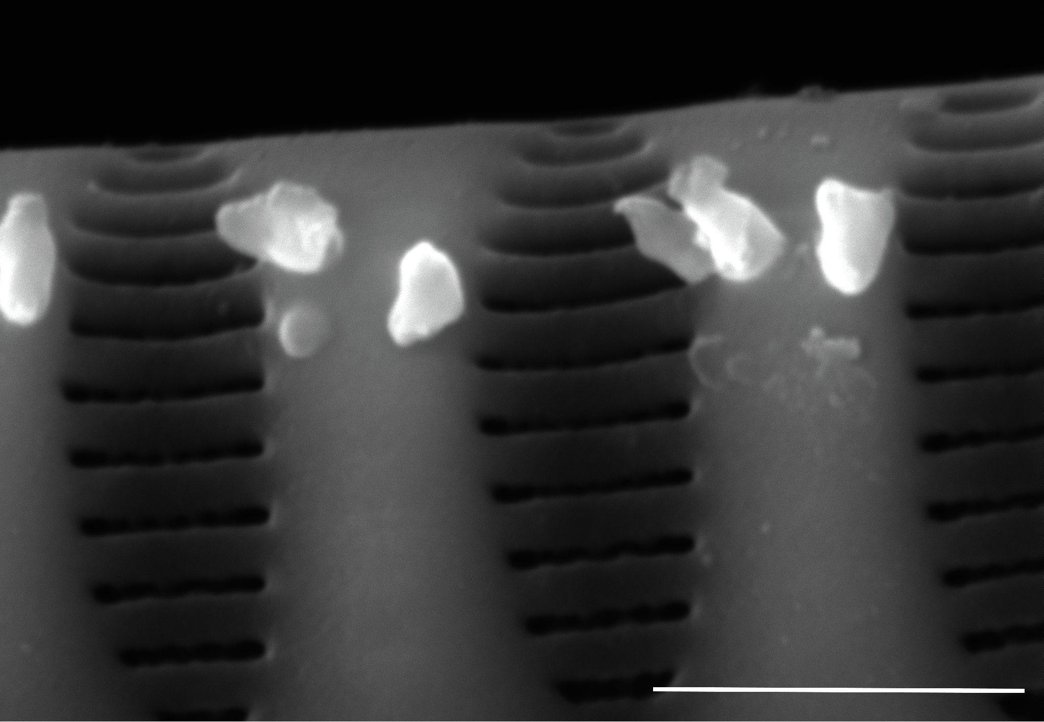 Staurosirella neopinnata SEM2