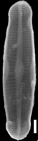 Achnanthidium duthiei SEM1
