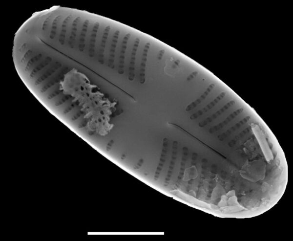 Sellaphora Atomoides Sem2