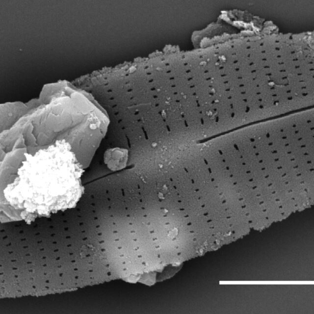  Craticula molestiformis SEM1