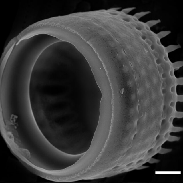 Aulacoseira alpigena SEM2