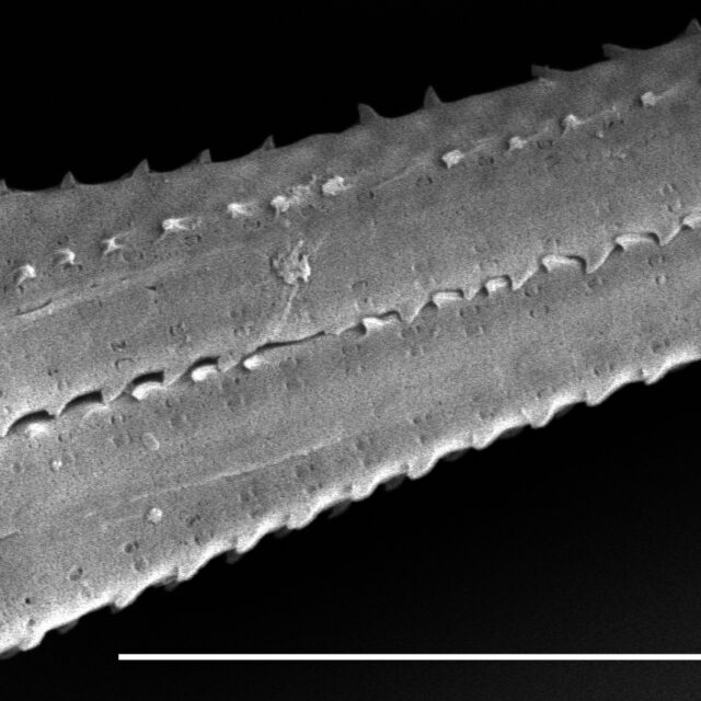 Fragilaria crotonensis SEM2