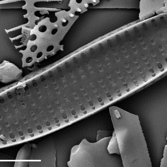 Pseudostaurosira americana SEM1