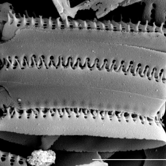 Stauroforma exiguiformis SEM1