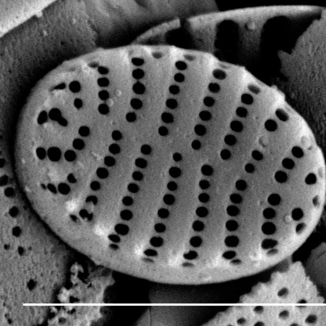 Stauroforma exiguiformis SEM2