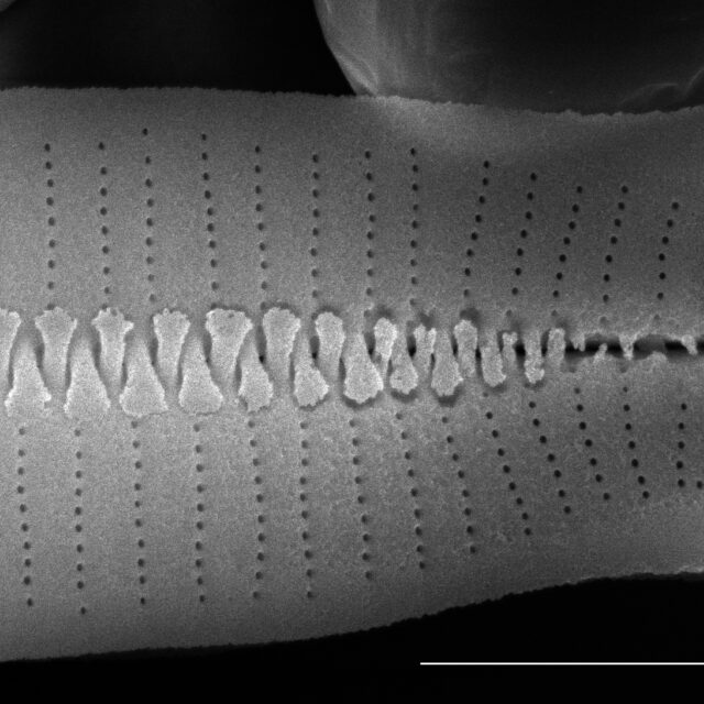 Fragilariforma virescens SEM1