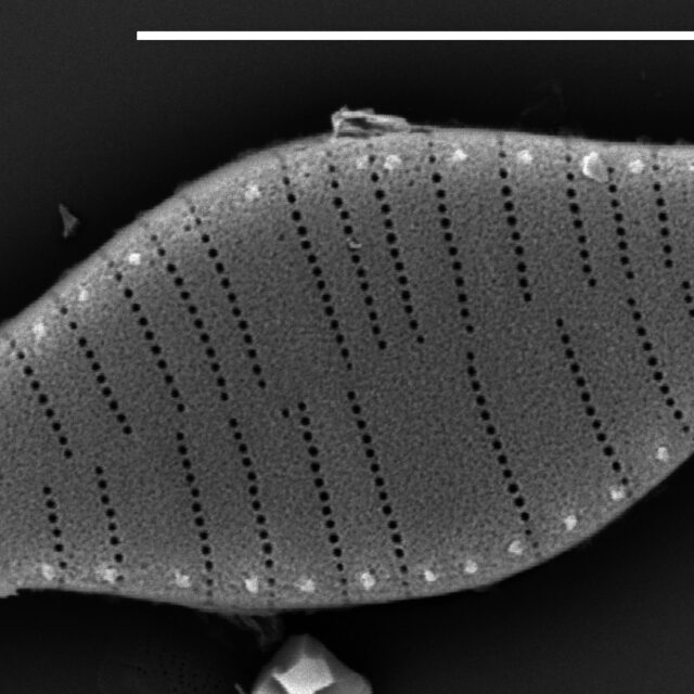 Fragilariforma bicapitata SEM2
