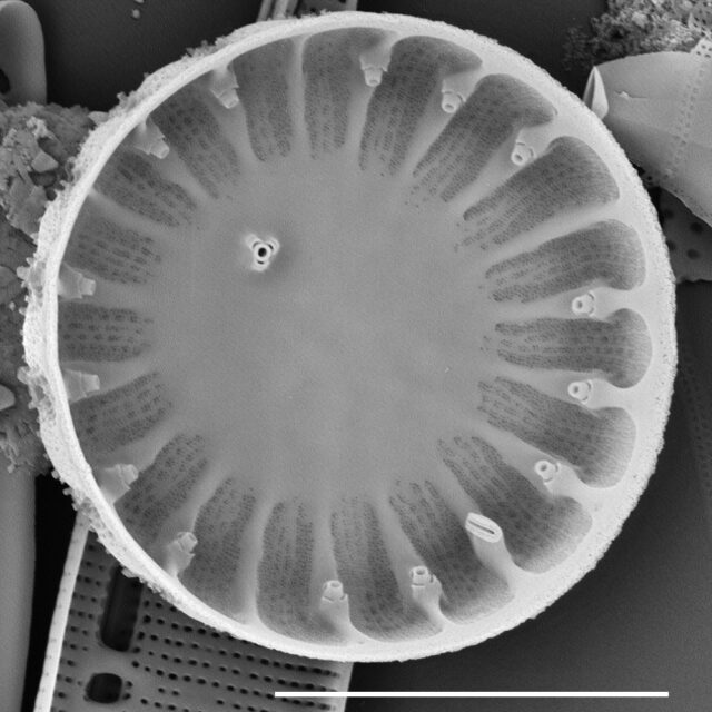 Cyclotella menenghiniana SEM4