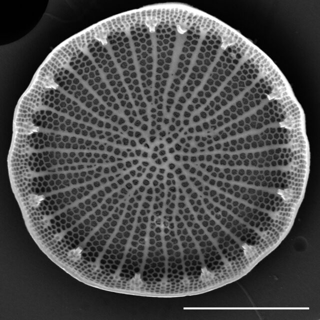 Stephanodiscus hantzschii f tenuis SEM1