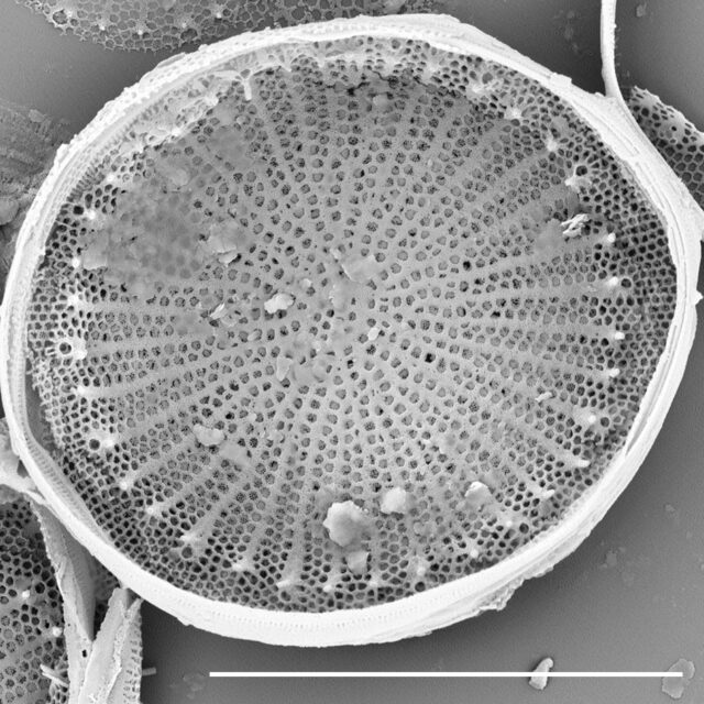 Stephanodiscus hantzschii f tenuis SEM3