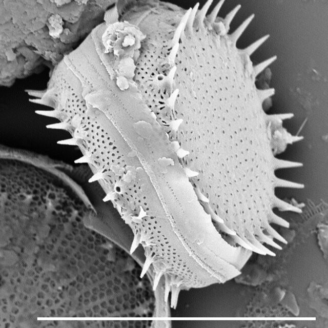 Stephanodiscus hantzschii SEM1