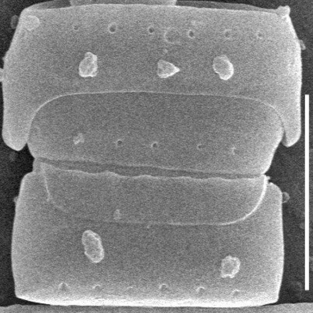 Diprora haenaensis SEM1