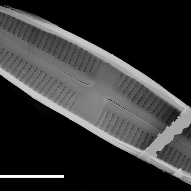 Rossithidium petersenii SEM1