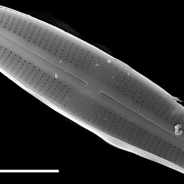 Rossithidium petersenii SEM2