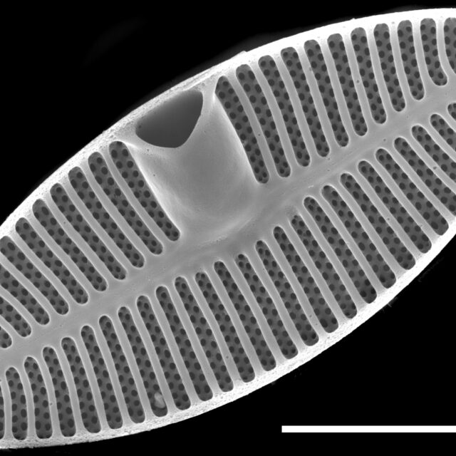 Planothidium oestrupii SEM1