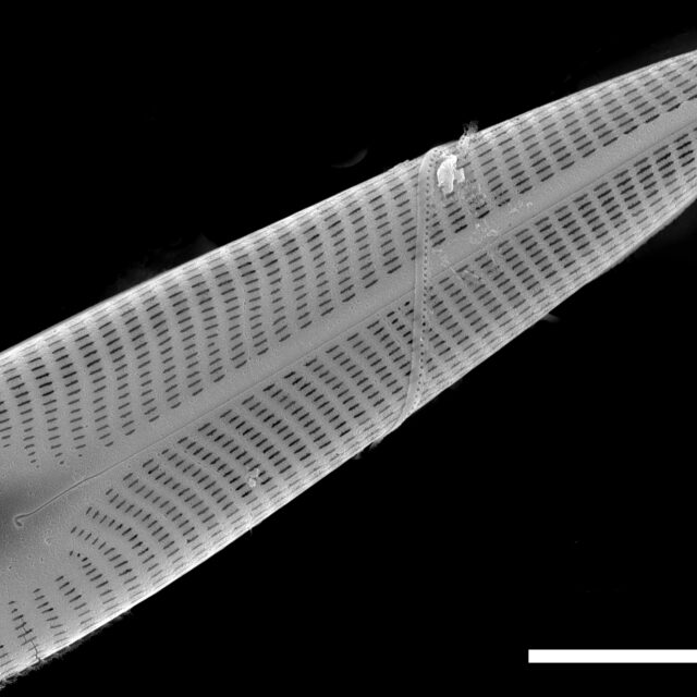 Navicula radiosa SEM1