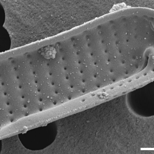 Eunotia mucophila SEM1