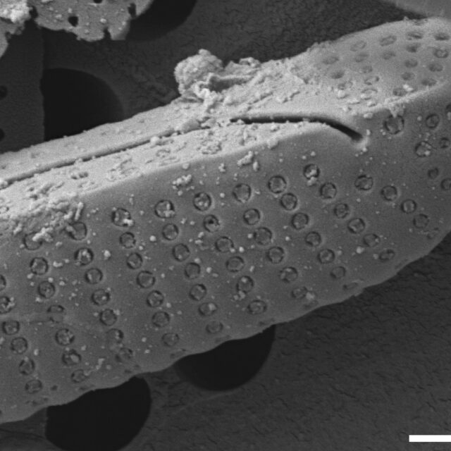 Eunotia novaeangliae SEM3