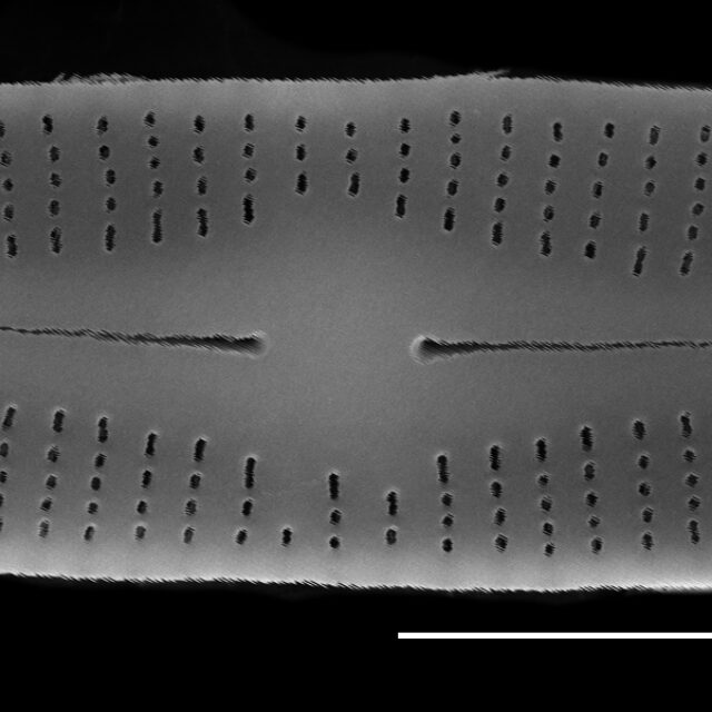 Achnanthidium crassum SEM1