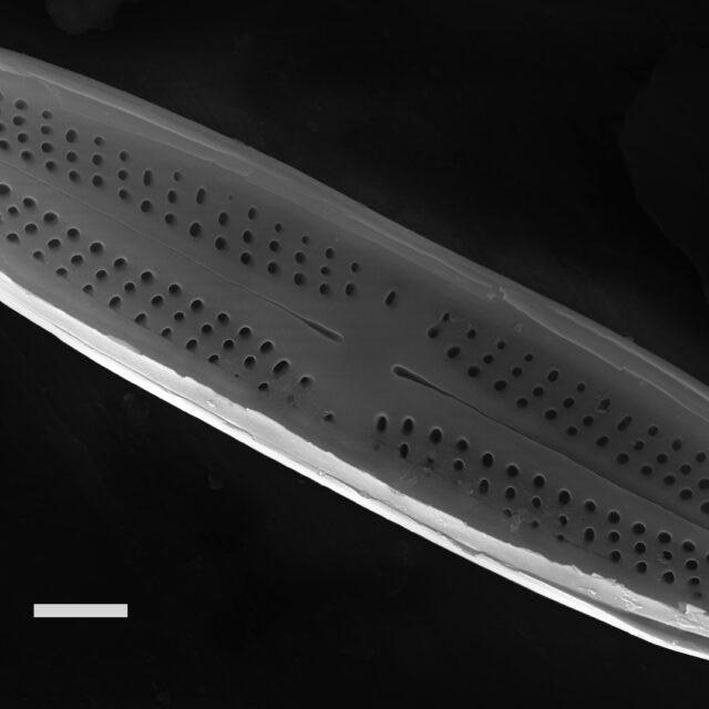 Achnanthidium minutissimum SEM2