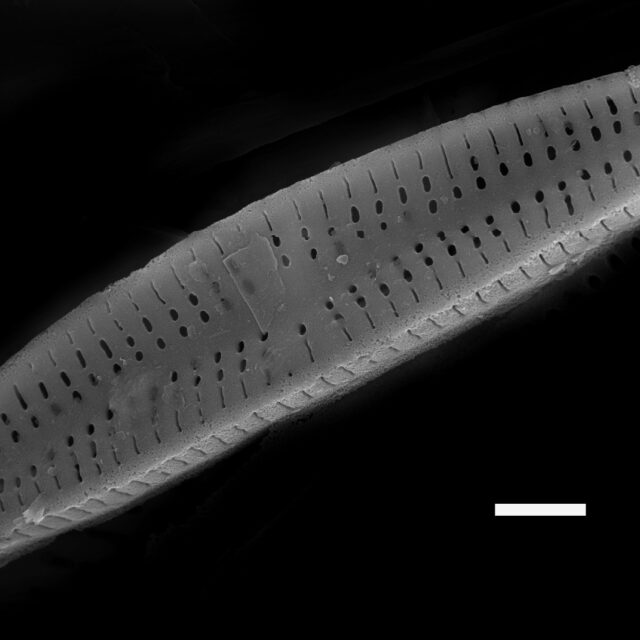 Achnanthidium minutissimum SEM4