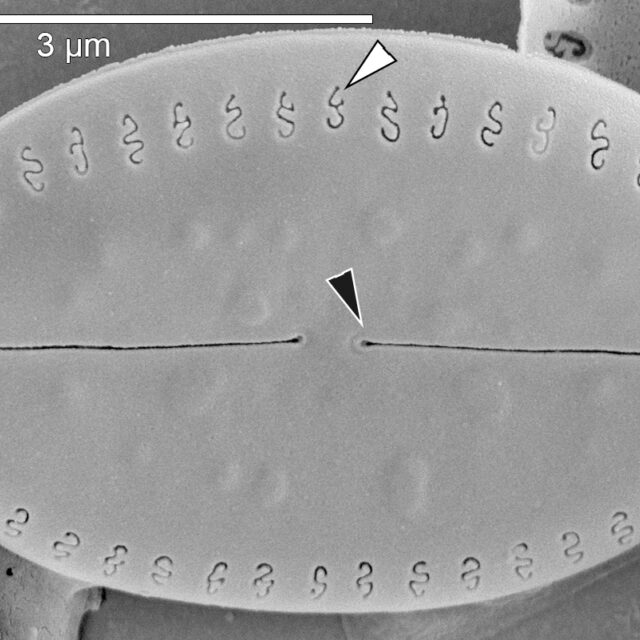 Amicula vermiculata SEM1