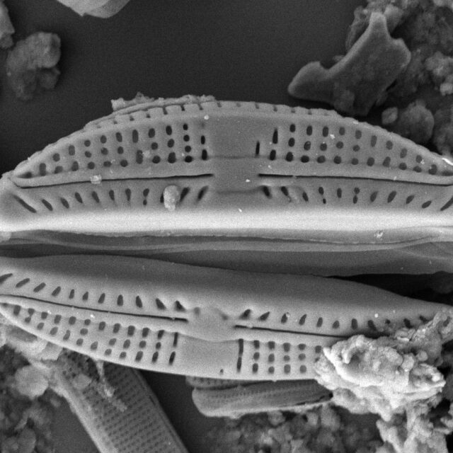 Amphora pediculus SEM1