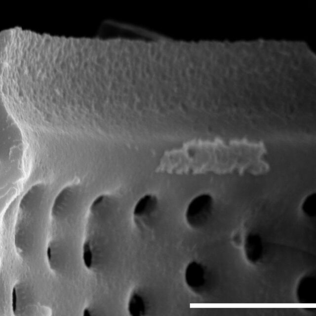 Aulacoseira newjerseyana SEM3