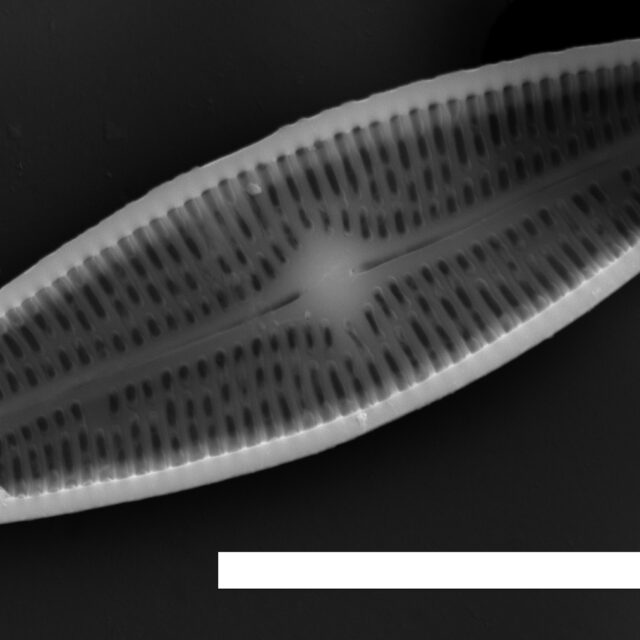 Brachysira confusa SEM5