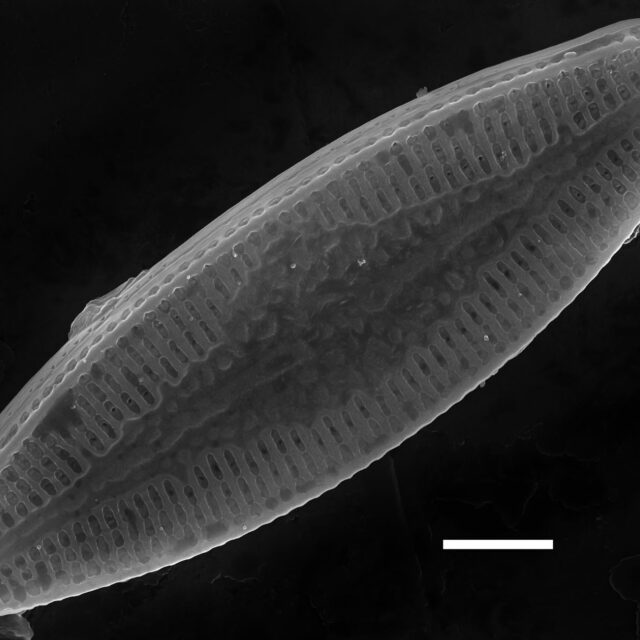 Nupela poconoensis SEM2