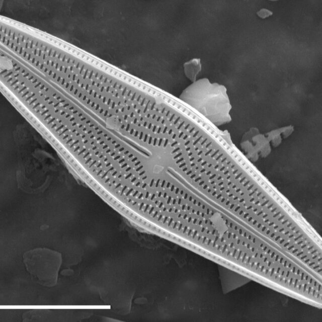 Brachysira brebissonii SEM1