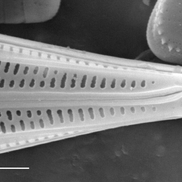 Brachysira neoacuta SEM1