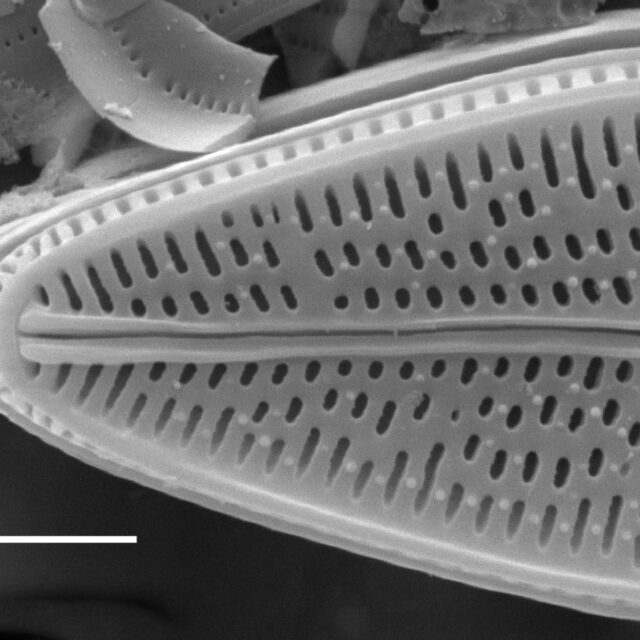 Brachysira brebissonii SEM3