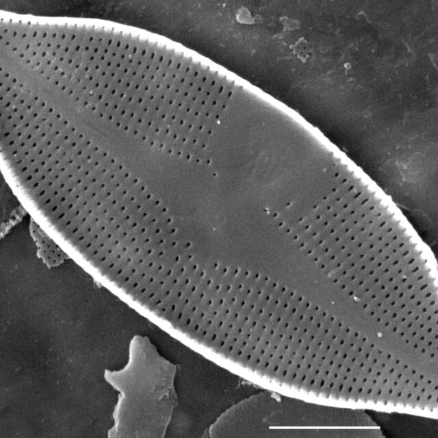 Nupela scissura SEM4