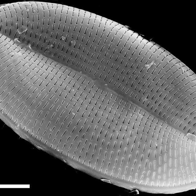 Cocconeis placentula SEM4