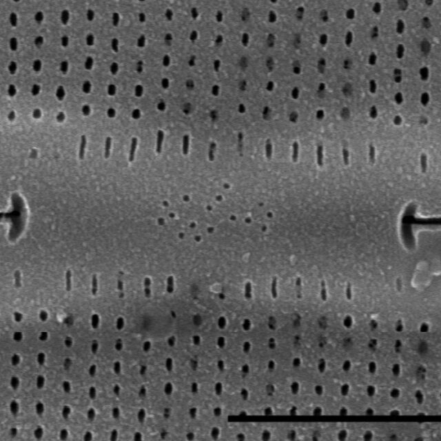 Frustulia rexii SEM2