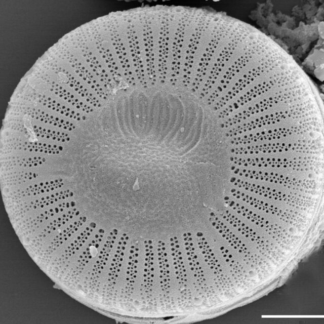 Cyclotella distinguenda SEM1